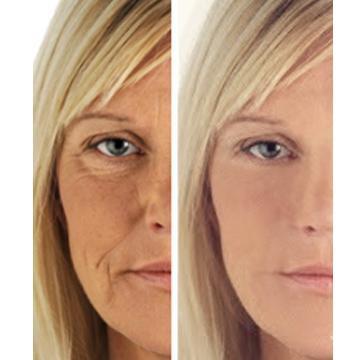 age perfect: night repair cream + vitamin c+ serum – a | dropsona - neutral - size reference
