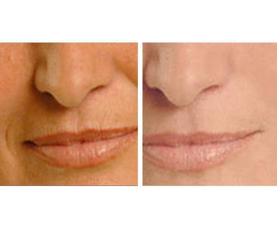 age perfect: night repair cream + vitamin c+ serum – a | dropsona - neutral - usage example
