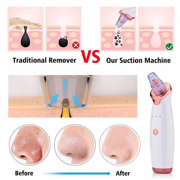 electric skin blackhead vacuum facial remove | dropsona - neutral - material texture